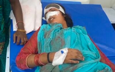 हरदोई में हैवानियत की हद पार, पति ने दांत से काटी नाक तो गुस्साई पत्नी ने काटा प्राइवेट पार्ट,पति गिरफ्तार