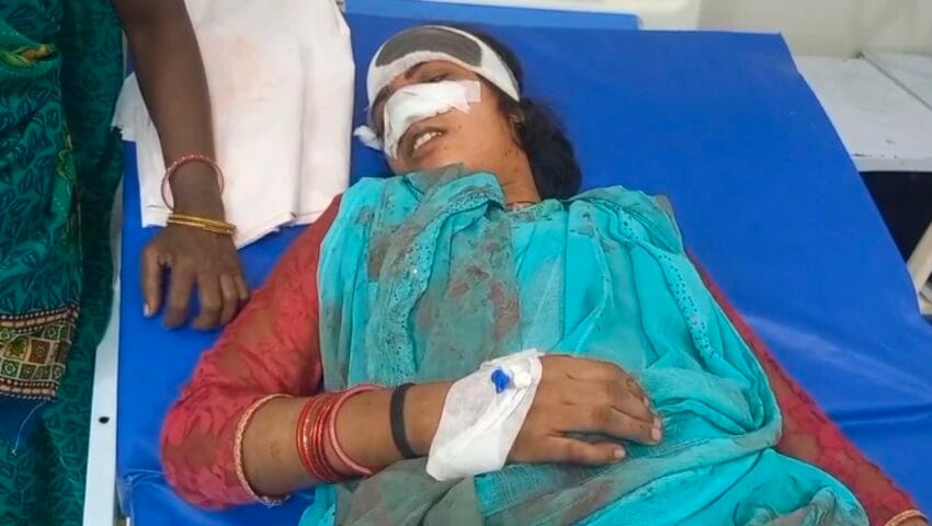 हरदोई में हैवानियत की हद पार, पति ने दांत से काटी नाक तो गुस्साई पत्नी ने काटा प्राइवेट पार्ट,पति गिरफ्तार