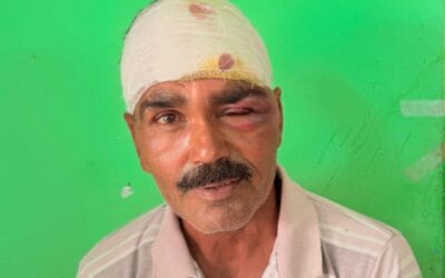 आवारा सांड ने किसान पर हमला कर किया घायल
