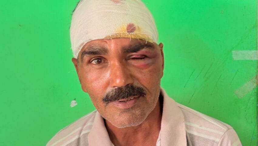 आवारा सांड ने किसान पर हमला कर किया घायल